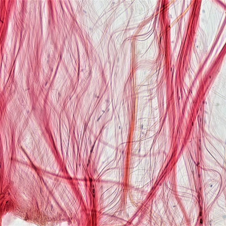 Rote, feine Linien und Fäden auf hellem Hintergrund.